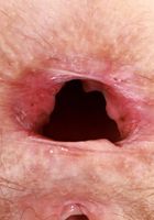 Jackie Hoff from ATK Natural & Hairy