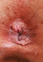 Summer Col Outside Latina Pussy and Ass, Summer Col (sum028) ATK Exotics: Summer Col (Summer Col Outside Latina Pussy and Ass)